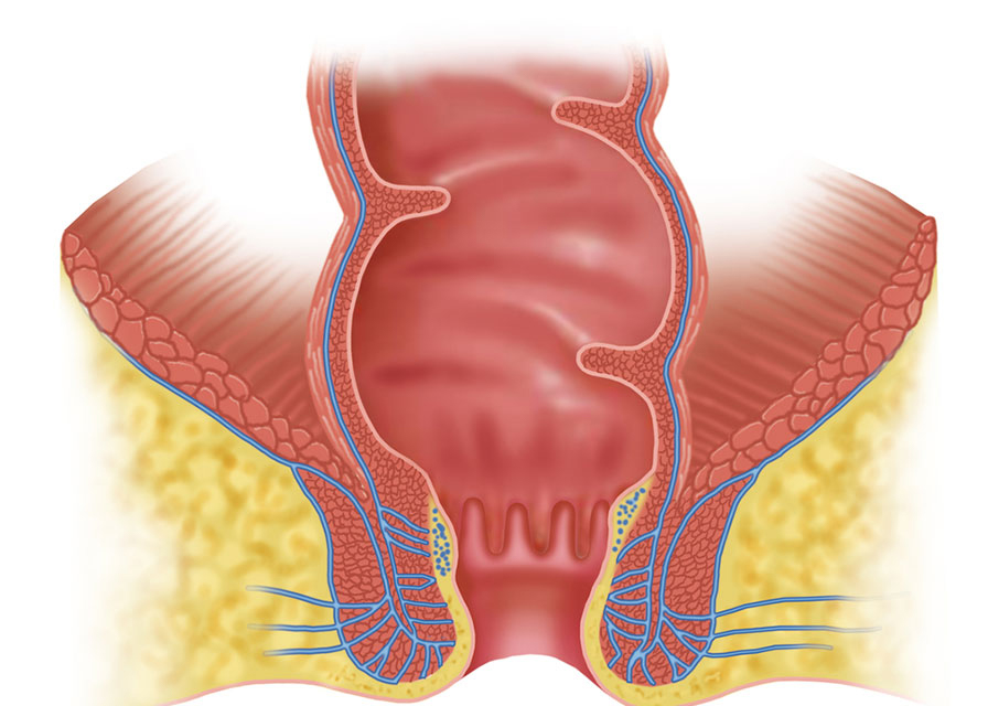 Anorectal Speciality